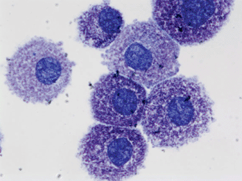 Image: Human mast cells (Photo courtesy of Madeleine Rådinger).